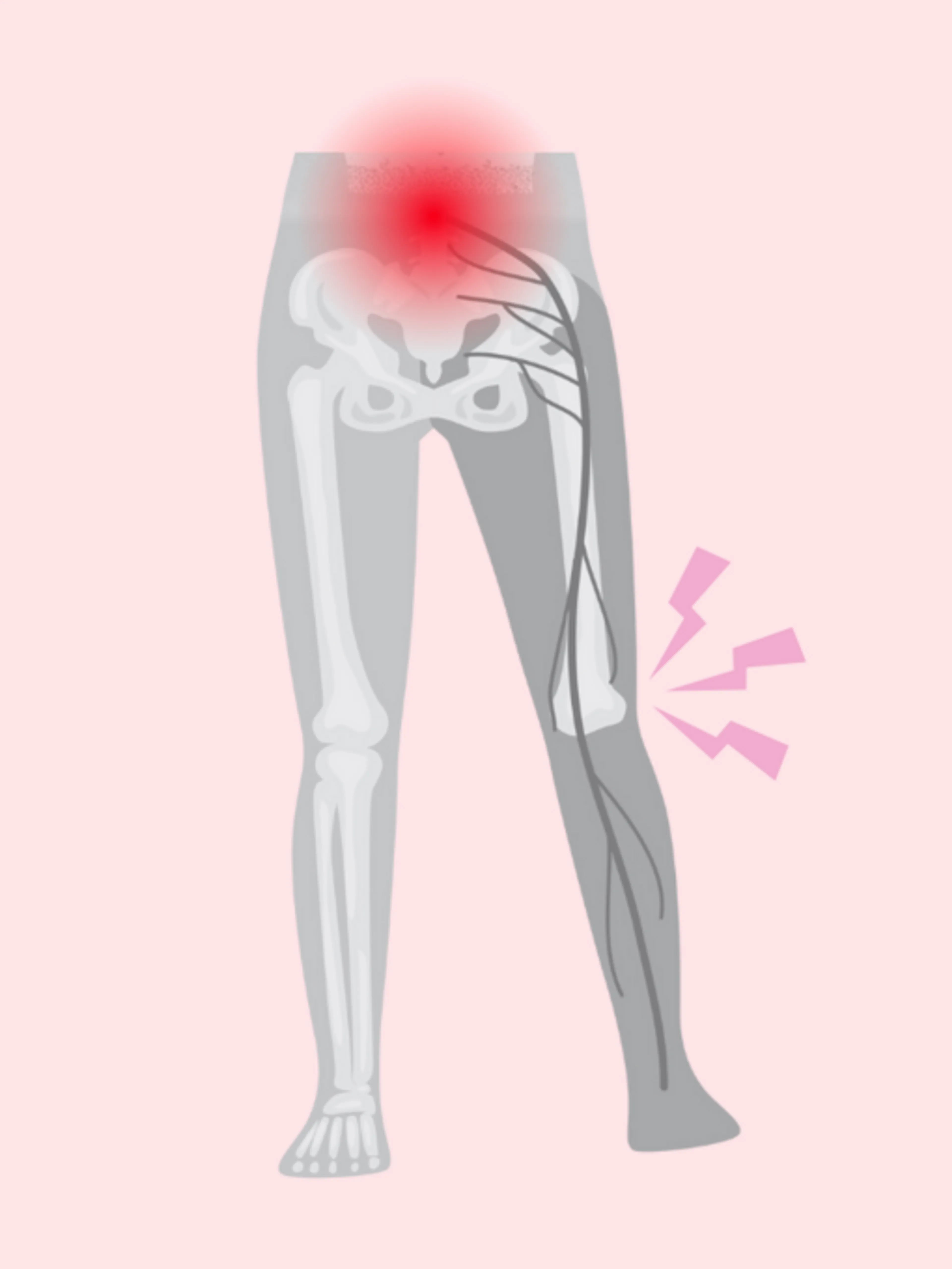 Image de présentation pour l'offre Douleurs de genou… et si ça venait du dos ? Comprendre, tester et agir. par Céline de Knee.lab